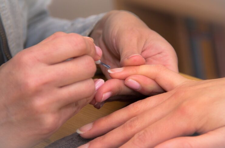 Experts Advice: Effective Methods for Dealing with Hangnails